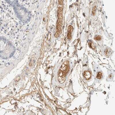 Immunohistochemistry-Paraffin: C8B Antibody [NBP1-85990]