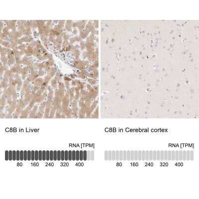 Immunohistochemistry-Paraffin: C8B Antibody [NBP1-85990]