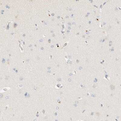 Immunohistochemistry-Paraffin: C8B Antibody [NBP1-85990]