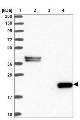 Western Blot: C8G Antibody [NBP2-14422]