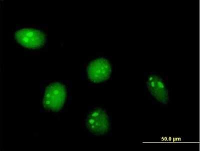 Immunocytochemistry/ Immunofluorescence: C8orf33 Antibody [H00065265-B01P]
