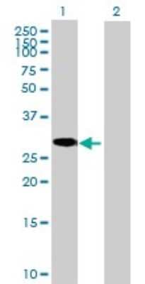 Western Blot: C8orf33 Antibody [H00065265-B01P]