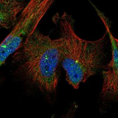 Immunocytochemistry/ Immunofluorescence: TTI2 Antibody [NBP1-82086]