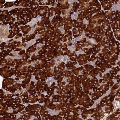 Immunohistochemistry-Paraffin: C8orf44 Antibody [NBP1-90418]