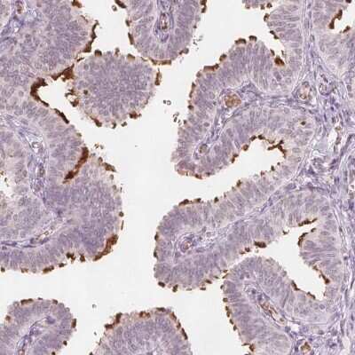 Immunohistochemistry-Paraffin: Glutamate Rich 5 Antibody [NBP1-93790]