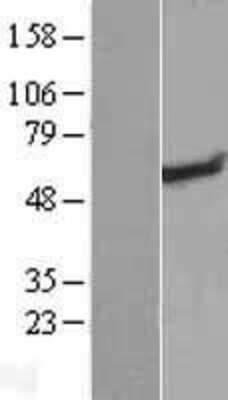 Western Blot: RAD26L Overexpression Lysate [NBL1-08579]