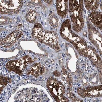Immunohistochemistry-Paraffin: C9orf103 Antibody [NBP1-88751]
