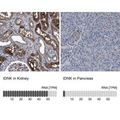Immunohistochemistry-Paraffin: C9orf103 Antibody [NBP1-88751]