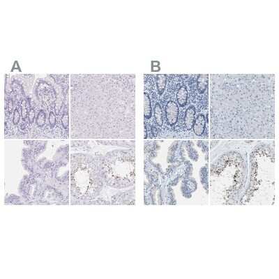Immunohistochemistry-Paraffin: EQTN Antibody [NBP1-90868]
