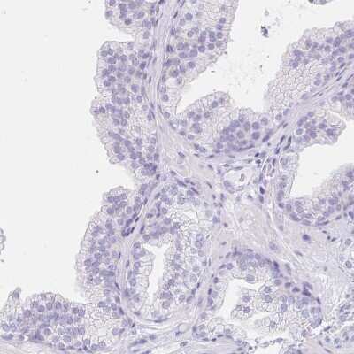 Immunohistochemistry-Paraffin: EQTN Antibody [NBP1-90868]