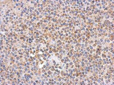 Immunohistochemistry-Paraffin: SPOUT1 Antibody [NBP2-15653]