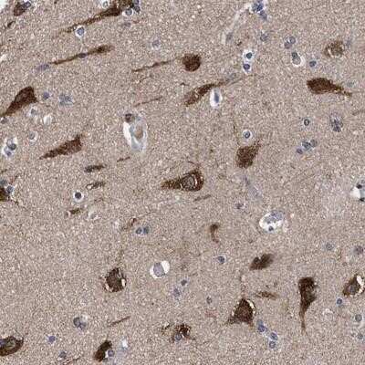 Immunohistochemistry-Paraffin: C9orf135 Antibody [NBP1-90684]