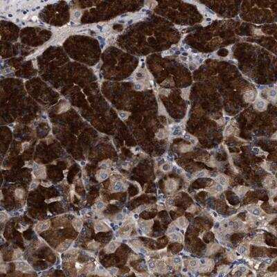 Immunohistochemistry-Paraffin: C9orf135 Antibody [NBP1-90685]