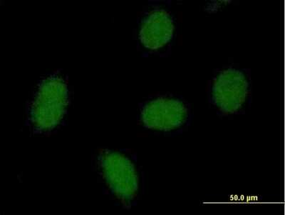 Immunocytochemistry/ Immunofluorescence: C9orf152 Antibody [H00401546-B01P]