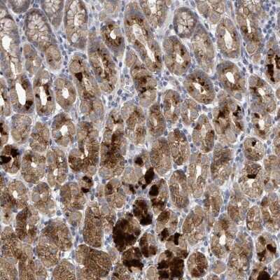 Immunohistochemistry-Paraffin: C9orf152 Antibody [NBP2-14423]
