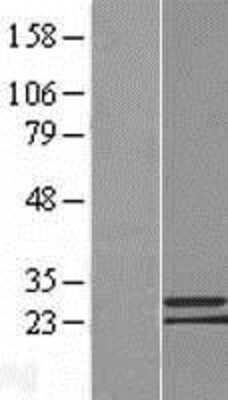 Western Blot: C9orf152 Overexpression Lysate [NBL1-08584]