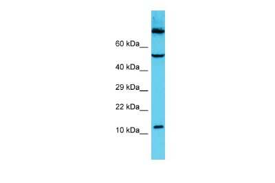 Western Blot: C9orf16 Antibody [NBP2-82953]