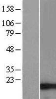 Western Blot: C9orf16 Overexpression Lysate [NBL1-08586]