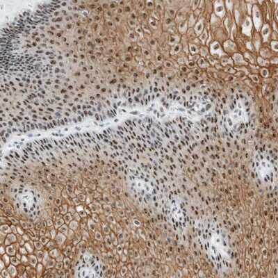 Immunohistochemistry-Paraffin: Cysteine Rich Tail 1 Antibody [NBP1-81056]