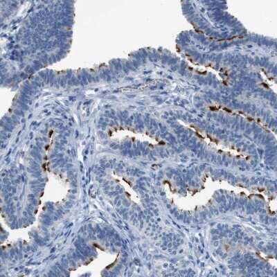Immunohistochemistry-Paraffin: CFAP77 Antibody [NBP1-93735]