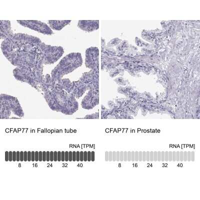 Immunohistochemistry-Paraffin: CFAP77 Antibody [NBP2-62635]