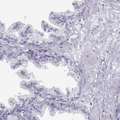 Immunohistochemistry-Paraffin: CFAP77 Antibody [NBP2-62635]