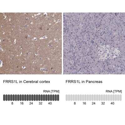 Immunohistochemistry-Paraffin: Ferric Chelate Reductase 1 Like Antibody [NBP2-58836]
