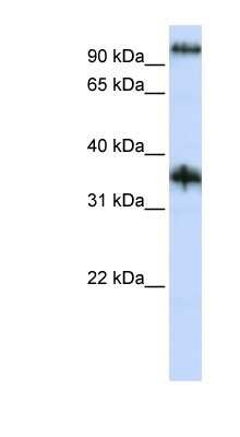 Western Blot: Ferric Chelate Reductase 1 Like Antibody [NBP1-59961]
