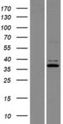 Western Blot: Ferric Chelate Reductase 1 Like Overexpression Lysate [NBP2-07352]