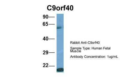 Western Blot: C9orf40 Antibody [NBP2-82960]