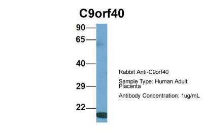 Western Blot: C9orf40 Antibody [NBP2-82960]