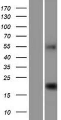 Western Blot: C9orf40 Overexpression Lysate [NBP2-06889]