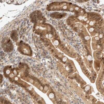 Immunohistochemistry-Paraffin: CARNMT1 Antibody [NBP1-82048]