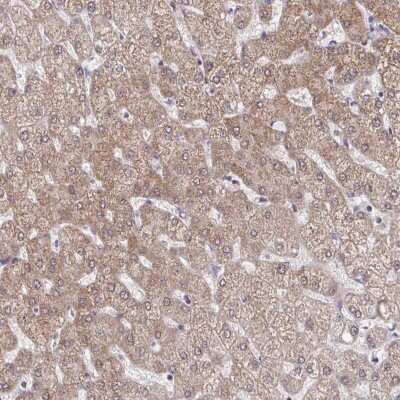 Immunohistochemistry: C9orf64 Antibody [NBP2-49155]