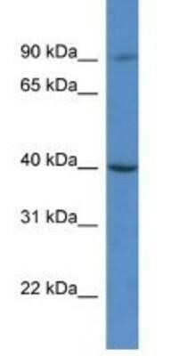 Western Blot: C9orf64 Antibody [NBP1-91505]