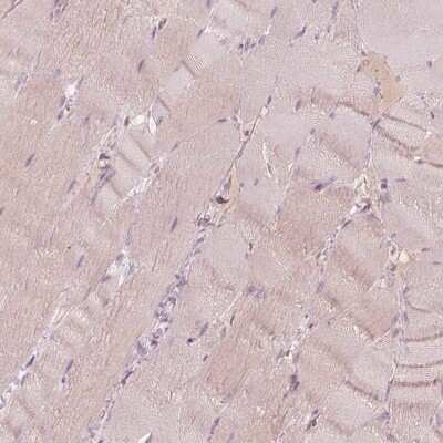 Immunohistochemistry-Paraffin: SPATA6L Antibody [NBP1-84648]