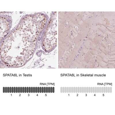 Immunohistochemistry-Paraffin: SPATA6L Antibody [NBP1-84648]