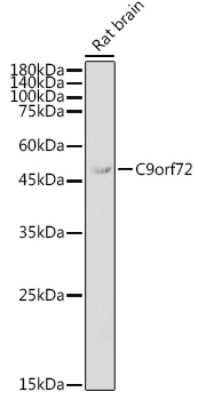 Western Blot: C9orf72 AntibodyAzide and BSA Free [NBP2-92755]