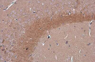 Immunohistochemistry-Paraffin: C9orf72 Antibody (GT1553) [NBP3-13622]