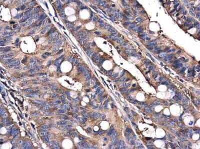 Immunohistochemistry-Paraffin: C9orf72 Antibody (779) [NBP3-13507]