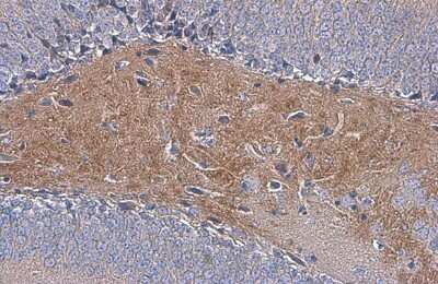 Immunohistochemistry-Paraffin: C9orf72 Antibody (779) [NBP3-13507]