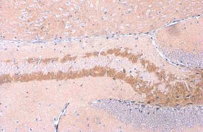 Immunohistochemistry-Paraffin: C9orf72 Antibody (779) [NBP3-13507]