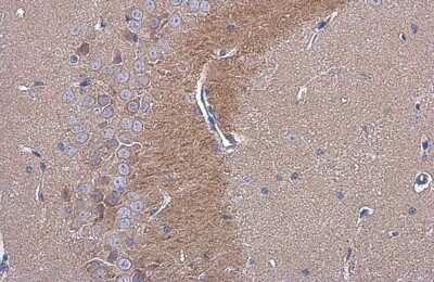 Immunohistochemistry-Paraffin: C9orf72 Antibody (779) [NBP3-13507]