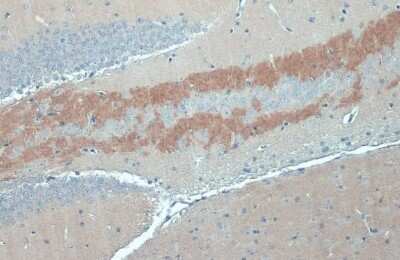 Immunohistochemistry-Paraffin: C9orf72 Antibody (779) [NBP3-13507]