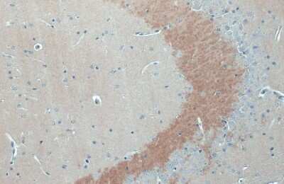 Immunohistochemistry-Paraffin: C9orf72 Antibody (779) [NBP3-13507]