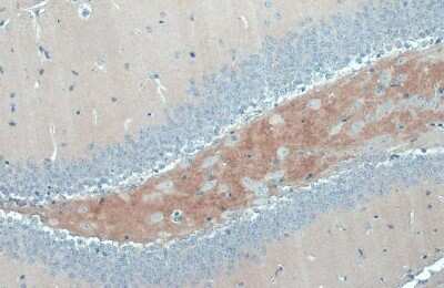 Immunohistochemistry-Paraffin: C9orf72 Antibody (779) [NBP3-13507]