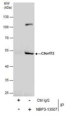 Immunoprecipitation: C9orf72 Antibody (779) [NBP3-13507]