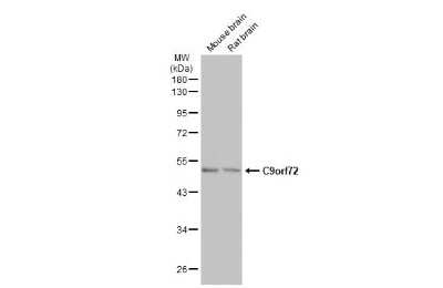 Western Blot: C9orf72 Antibody (GT779-RB) [NBP3-13657]