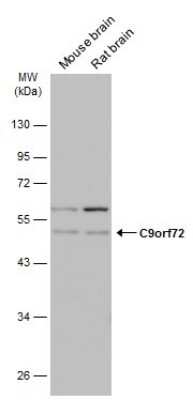 Western Blot: C9orf72 Antibody (779) [NBP3-13507]