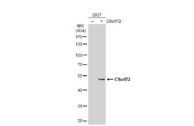 Western Blot: C9orf72 Antibody (779) [NBP3-13507]